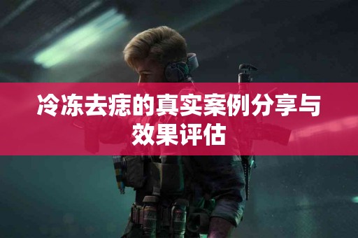 冷冻去痣的真实案例分享与效果评估